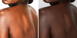 Skin Goals Showdown: Brightening vs. Lightening