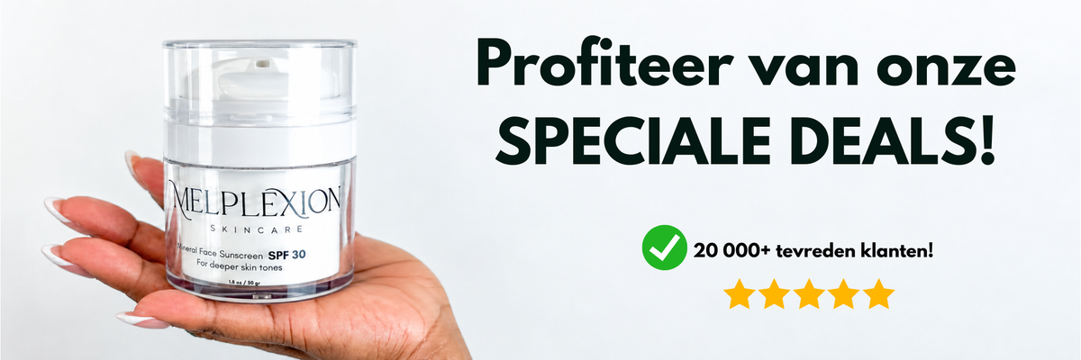 SPECIAL DEALS