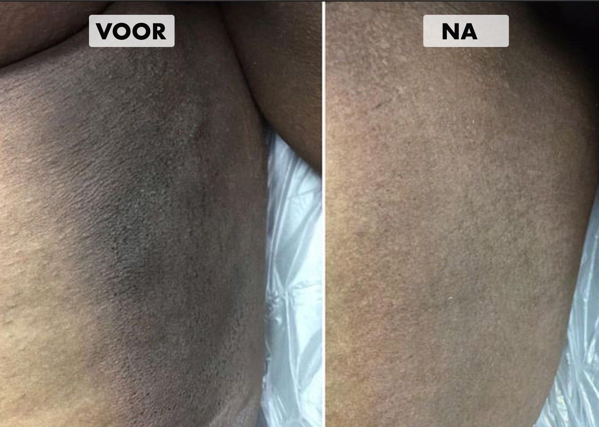 Promotiebanner